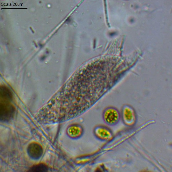 Altra Stylonychia diversamente abile?